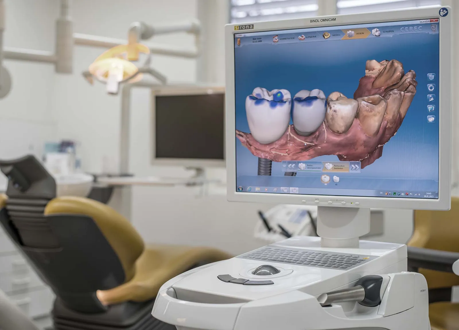Behandlungsplatz mit Bildschirm für die CEREC-Planung